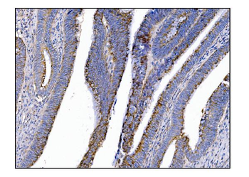 MERTK Rabbit Polyclonal Antibody