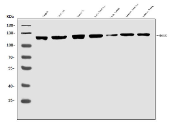 MERTK Rabbit Polyclonal Antibody