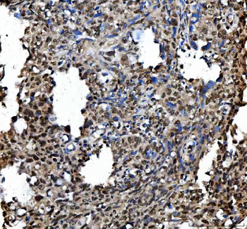 Ki67/Mki67 Rabbit Polyclonal Antibody