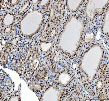 Ki67/Mki67 Rabbit Polyclonal Antibody