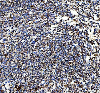 Ki67/Mki67 Rabbit Polyclonal Antibody