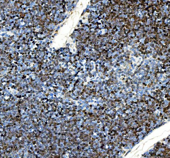 Ki67/Mki67 Rabbit Polyclonal Antibody