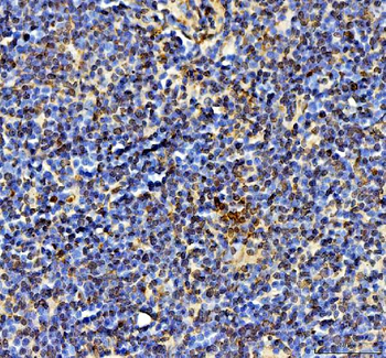 Ki67/Mki67 Rabbit Polyclonal Antibody