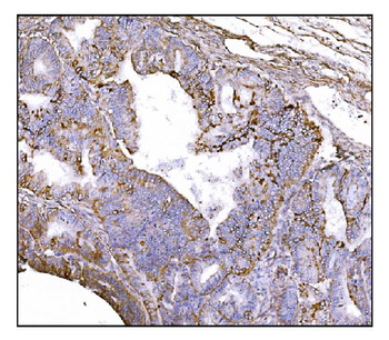 NDEL1 Rabbit Polyclonal Antibody