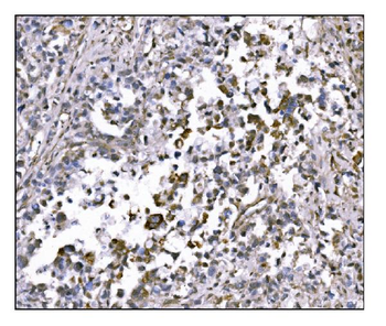 NDEL1 Rabbit Polyclonal Antibody