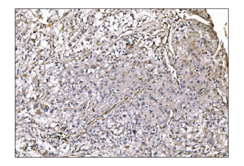 NDEL1 Rabbit Polyclonal Antibody