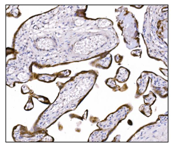 NDEL1 Rabbit Polyclonal Antibody