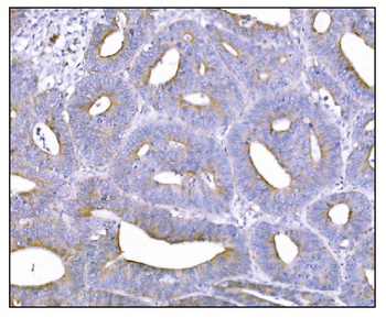 NDEL1 Rabbit Polyclonal Antibody