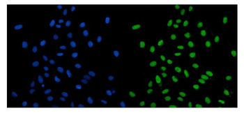 SCC112/PDS5A Rabbit Polyclonal Antibody