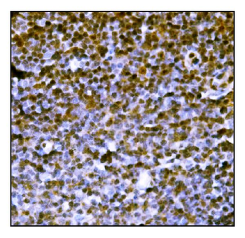 PML Protein/Pml Rabbit Polyclonal Antibody