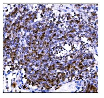 PML Protein/Pml Rabbit Polyclonal Antibody