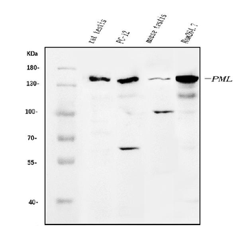 PML Protein/Pml Rabbit Polyclonal Antibody