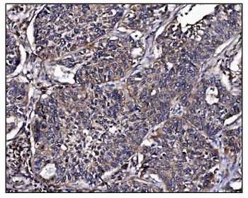 POGLUT1 Rabbit Polyclonal Antibody