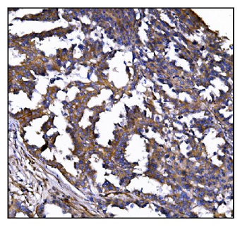 POGLUT1 Rabbit Polyclonal Antibody