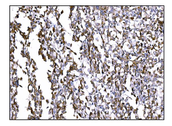 Prolyl Endopeptidase/PREP Rabbit Polyclonal Antibody