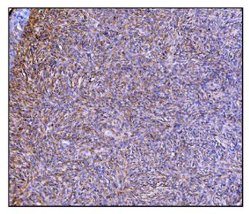 Prolyl Endopeptidase/PREP Rabbit Polyclonal Antibody