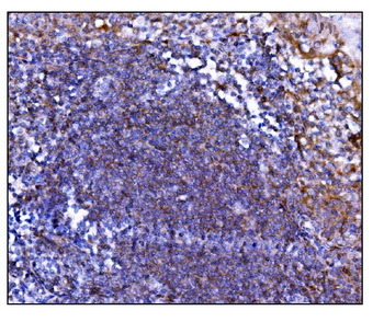 Prolyl Endopeptidase/PREP Rabbit Polyclonal Antibody