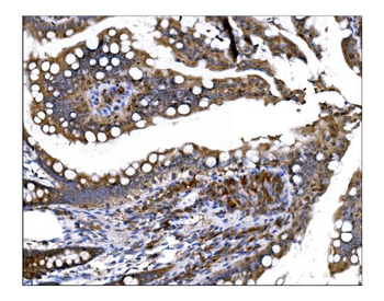 Prolyl Endopeptidase/PREP Rabbit Polyclonal Antibody