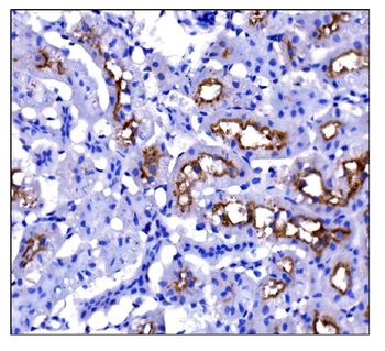 CD133/Prom1 Rabbit Polyclonal Antibody