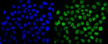 SUMO2/3 Rabbit Polyclonal Antibody