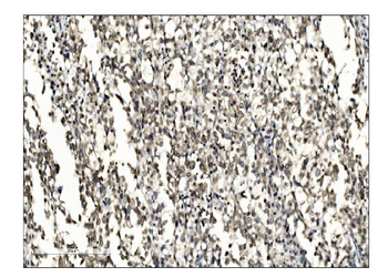 SUMO2/3 Rabbit Polyclonal Antibody