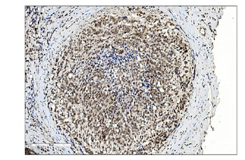 SUMO2/3 Rabbit Polyclonal Antibody