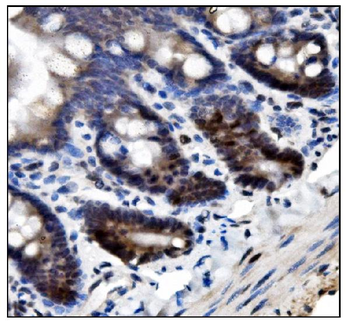 SUMO2/3 Rabbit Polyclonal Antibody