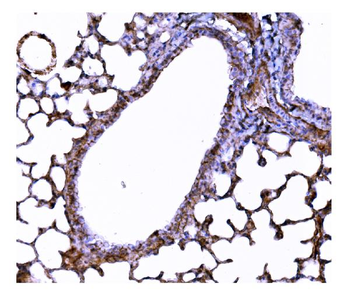 Superoxide Dismutase 3/EC-SOD/Sod3/EC Rabbit Polyclonal Antibody