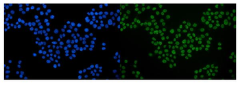 Serum Response Factor/SRF Rabbit Polyclonal Antibody
