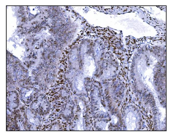 Serum Response Factor/SRF Rabbit Polyclonal Antibody