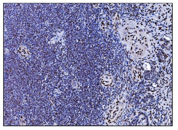 Serum Response Factor/SRF Rabbit Polyclonal Antibody