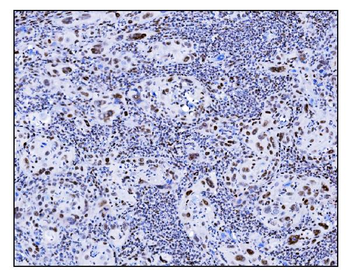 Serum Response Factor/SRF Rabbit Polyclonal Antibody