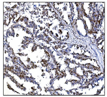 Serum Response Factor/SRF Rabbit Polyclonal Antibody