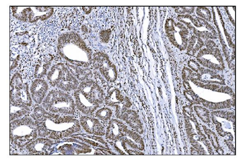 Serum Response Factor/SRF Rabbit Polyclonal Antibody