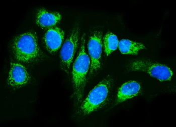 TRAP alpha/TRAPA/SSR1 Rabbit Polyclonal Antibody