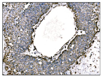TRAP alpha/TRAPA/SSR1 Rabbit Polyclonal Antibody