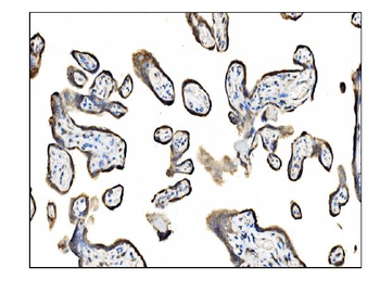 TRAP alpha/TRAPA/SSR1 Rabbit Polyclonal Antibody
