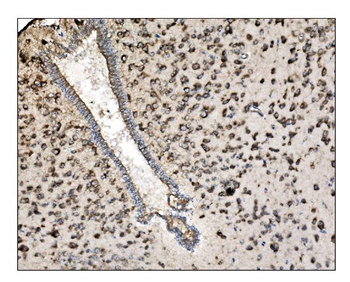 TRAP alpha/TRAPA/SSR1 Rabbit Polyclonal Antibody