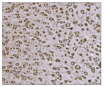 TRAP alpha/TRAPA/SSR1 Rabbit Polyclonal Antibody