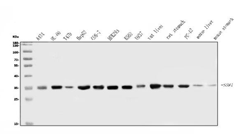 TRAP alpha/TRAPA/SSR1 Rabbit Polyclonal Antibody