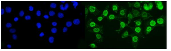 KMT1B/SUV39H2 Rabbit Polyclonal Antibody