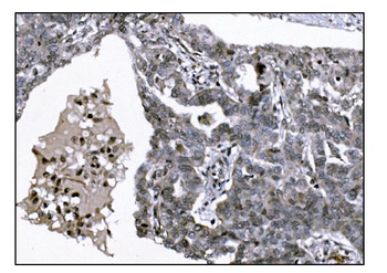 KMT1B/SUV39H2 Rabbit Polyclonal Antibody