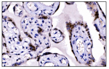 KMT1B/SUV39H2 Rabbit Polyclonal Antibody