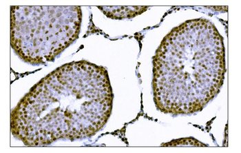 KMT1B/SUV39H2 Rabbit Polyclonal Antibody