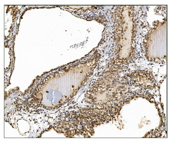 AS160/TBC1D4 Rabbit Polyclonal Antibody