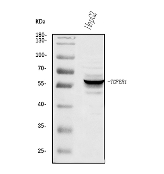 TGF beta Receptor I/TGFBR1 Rabbit Polyclonal Antibody