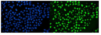 Ki67 Mouse Monoclonal Antibody