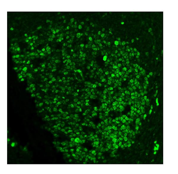 Ki67 Mouse Monoclonal Antibody