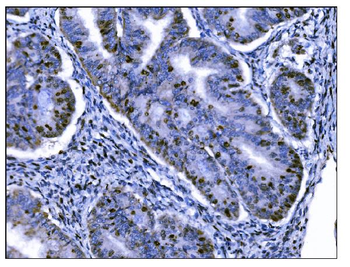 Ki67 Mouse Monoclonal Antibody