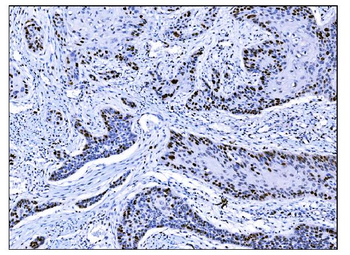 Ki67 Mouse Monoclonal Antibody